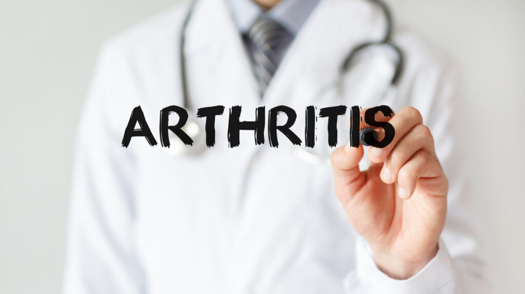 Tips for Effective Arthritis Prevention